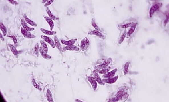protozoan parasite toxoplasma gondii cause toxoplasmosis